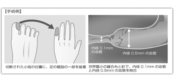 手術例