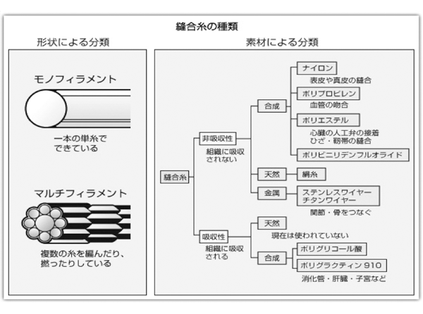 縫合糸の種類